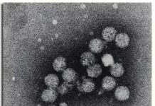 Minor Girl Dies, Several Infected After Suspected Hepatitis Outbreak In Kulgam Village Hepatitis-C Virus