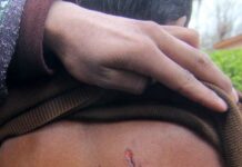 Dogs Taking Toll On Tourists,09 Injured