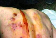 Pellets Fired In Baramulla,17 Injured