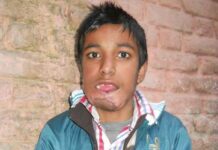 Disfigured childhood