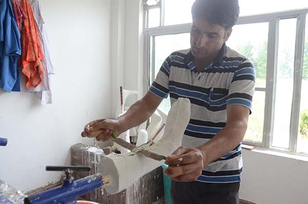 Technician shaping up artificial limb of one of the clients.