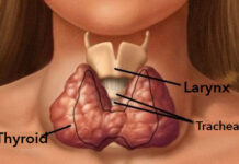 Hypothyroidism: ‘A Cause of Concern in Kashmir’s Young Female Lot’