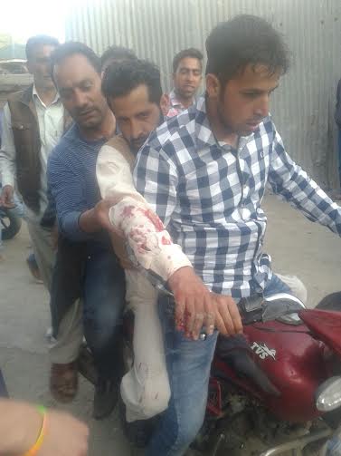 One of the injured being taken to Hospital. (KL IMAGE)