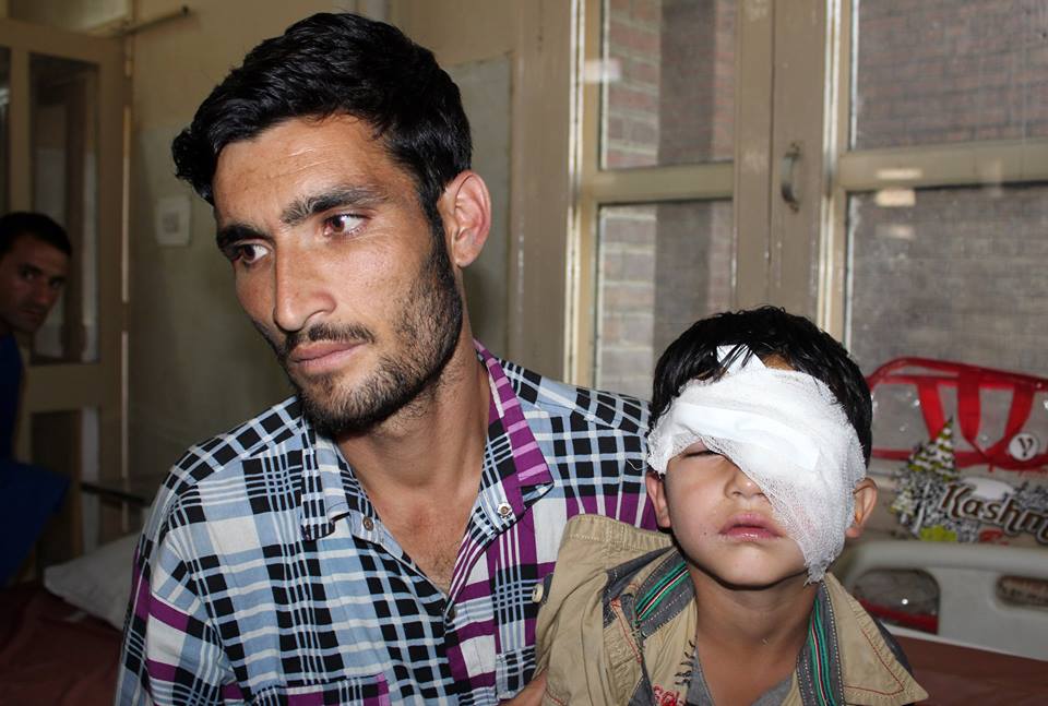 Five year old boy, Nasir Altaf, was hit byb pellets in Kokernag area on Friday. (KL Image courtesy: Umar Ganie)