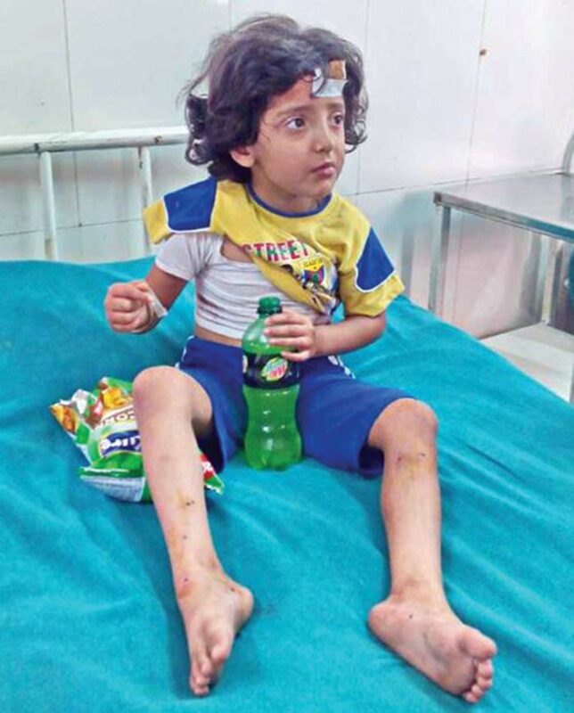 Injured-5-year-old-girl