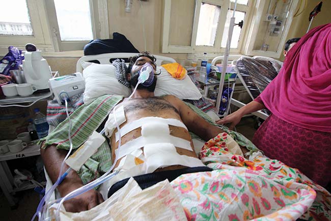 Ghulam Mohidin Bhat, 24, has over hundred pellets in his body. 