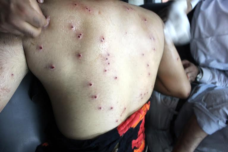 A pellet victim fro Islamabad district. (KL file Image)