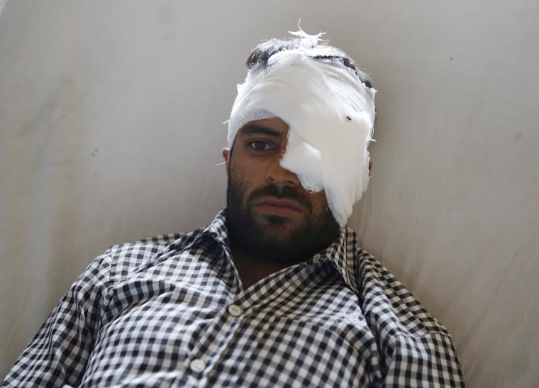 A pellet victim in SMHS Srinagar. (KL Image: Bilal Bahadur)