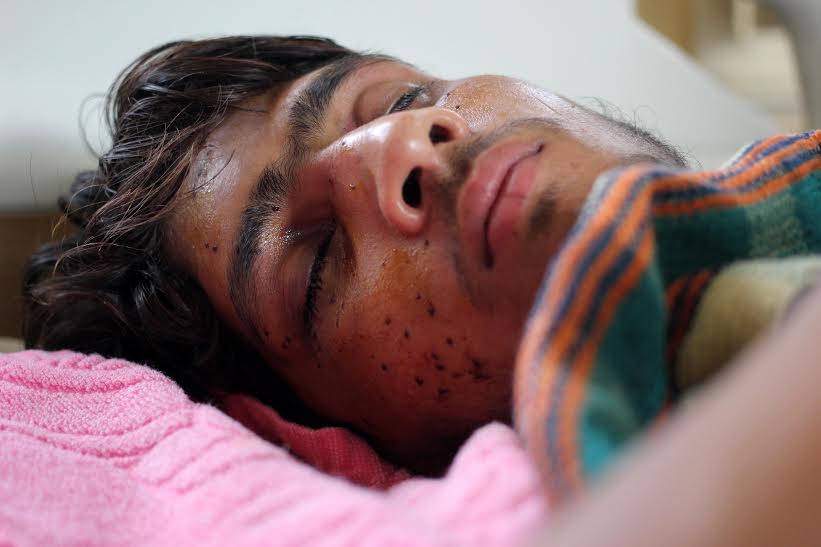 A pellet hit youth being treated at SMHS Srinagar. (KL Image: Bilal Bahadur)