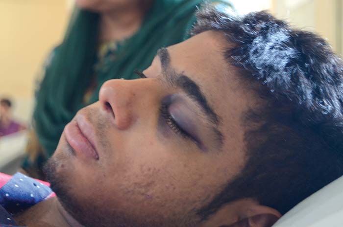 Pellet-injuries-