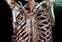 Missing man from Feb 26, police recovers skeleton in Pampore