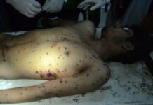 Mohammad Amir Mir was by pellets in Prichoo area of Pulwama on August 24, 2016. He died in SMHS Hospital Srinagar. (KL Image: Bilal Bahadur)