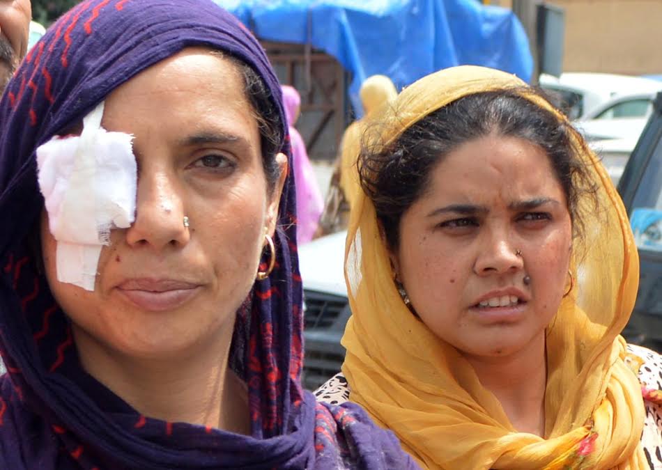The ladies who were injured on Monday pellet firing in South Kashmir's Bijbehara. (KL Images: Bilal Bahadur)