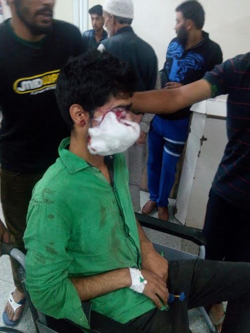 One of the injured youths in forces action on August 29, 2016 at SMHS Hospital Srinagar.