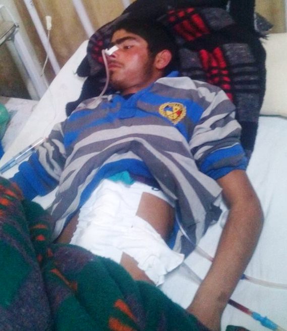 Mir Amir Ahmad in SMHS on February 15, 2016 after he was hit by a tear gas shell in Lelhaar area of Pulwama district.