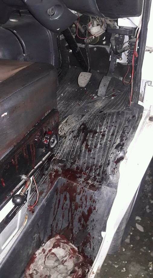 Blood stains of the ambulance driver in 