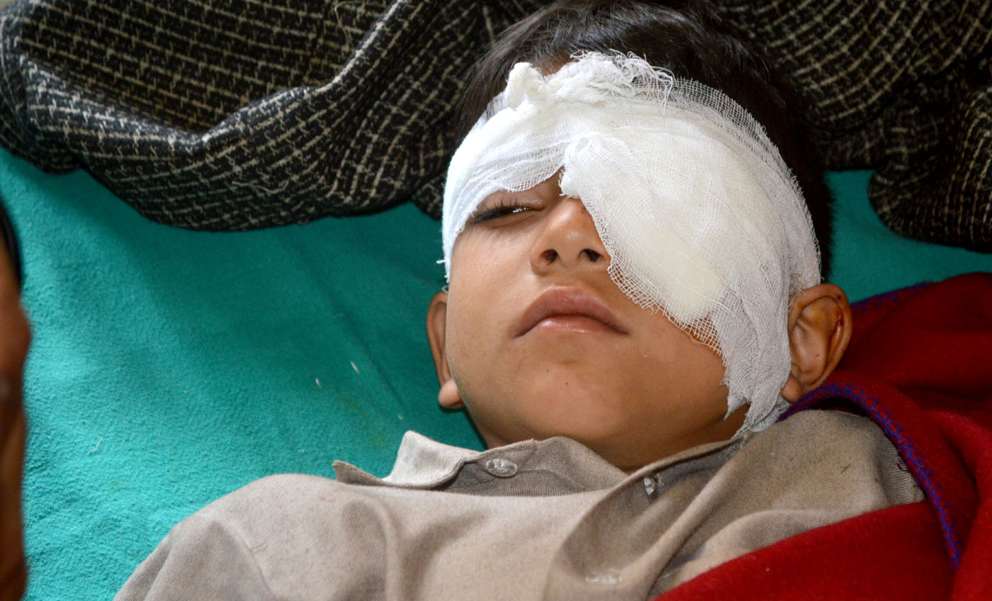 Shahid A Bhat of Khaag admitted at Srinaagr's SMHS Hospital. (Photo courtesy: Mehraj Bhat/KL)
