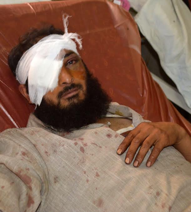 The pellet gun manufacturer said that no tests have been conducted regarding their effect on the human body. A pellet hit victim lying on a bed at SMHS Hospital Srinagar after being given treatment on September 07, 2016. (KL Image: Bilal Bahadur)
