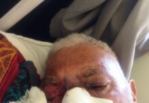 #Day76: Hit by a Mysterious ‘Army’ Shell, A Pulwama Elder Rendered Blind