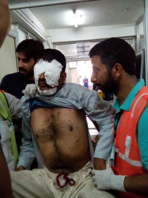 A pellet hit victim being shifted to ward at SMHS Hospital after being treated by doctors on Sep 07, 2016.