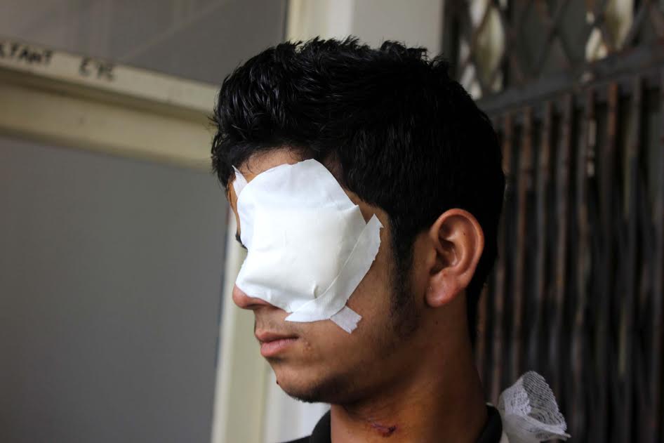 The youth hit by pellets in left eye in Khudwani area of Kulgam was treated at district hospital Islamabad on August 31, 2016. (KL Image: Shah Hilal)