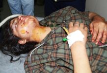 #Day115: Pellet Terror Returns As Two Pulwama Teenage Girls Hit In Face, One In Eyes