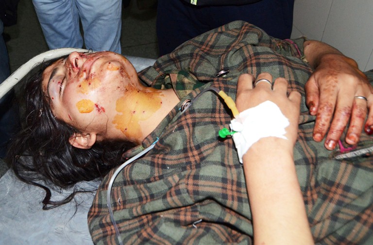Ifra Jan, 13, was hit and injured by pellets fired by forces in Rahmoo village of Pulwama district on Oct 31, 2016 being shifted to SMHS Hospital Srinagar. (KL Image: Bilal Bahadur)