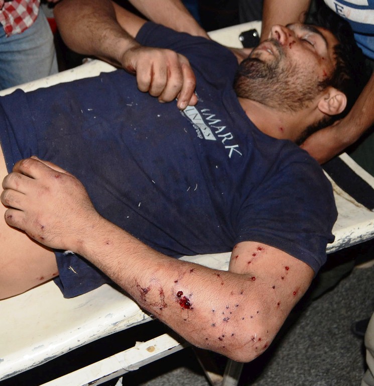 Mehraj Din, a youth from Rahmoo Pulwama, hit and injured by pellets being shifted to SMHS Hospital Srinagar on Oct 31, 2016. (KL Image: Bilal Bahadur)