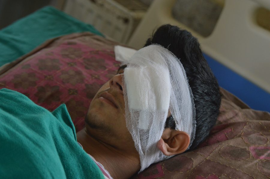 eye-pellet-victims-4
