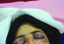 Lalla Rookh Eyes