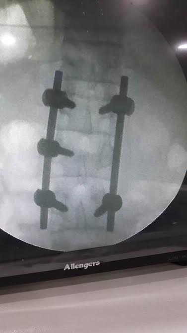 The X-Ray