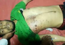 Youth shot by pellets in Pulwama succumbs