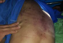 Lolab youth ‘disappears’, another claims torture by Army