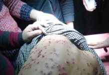 Four injured in Qaimoh clashes, Mirwaiz condemns