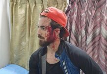 Kashmiri student assaulted in Bengaluru, Sustains injuries