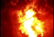 South Kashmir Truck Driver Critical After Severe Burn Injuries in Delhi