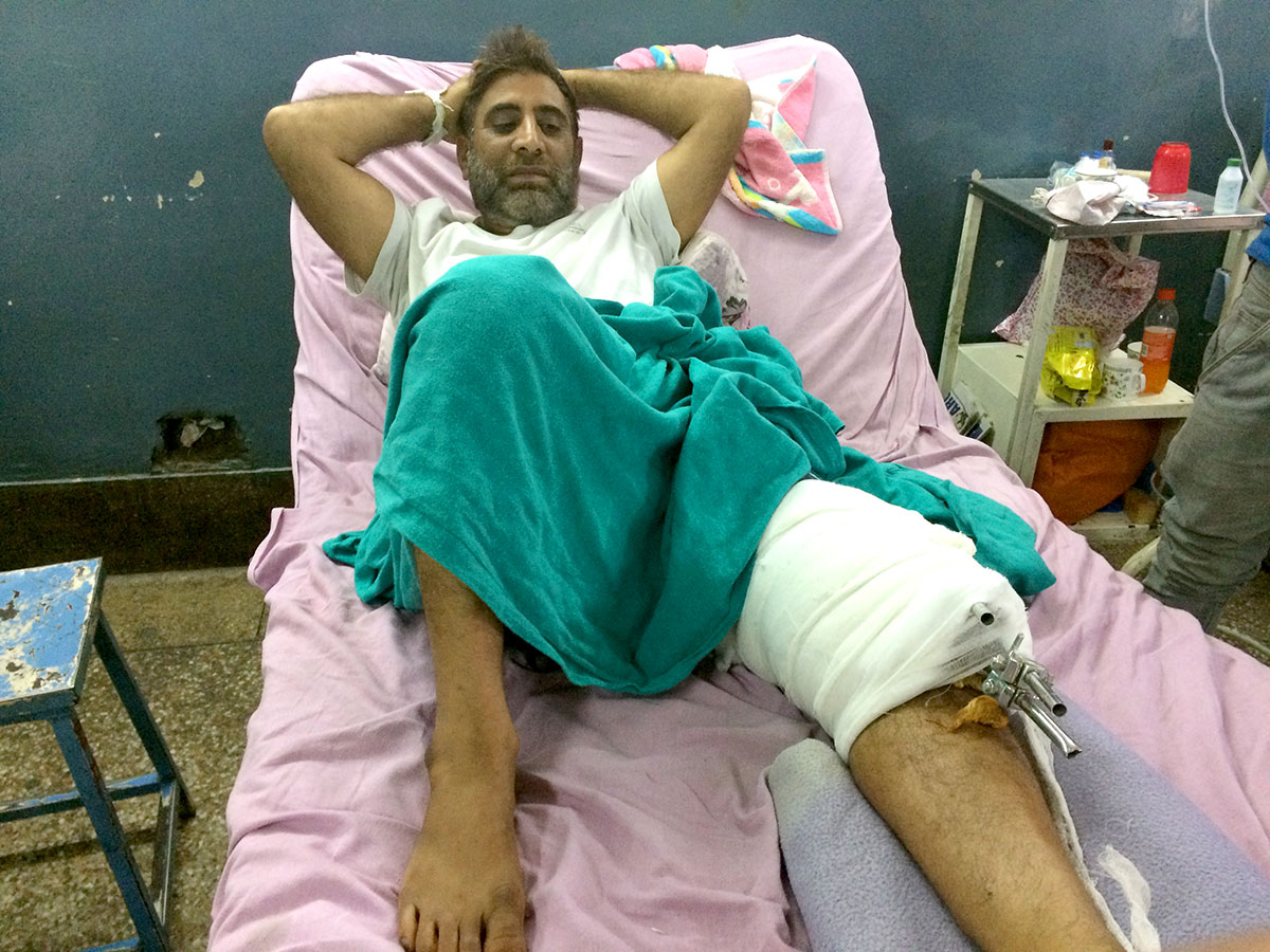 Mohammad Ramzan, Sopore based apple trader was shot in the leg.