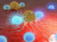 Cancer cells shown here with lymphocytes.