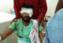 Cellphone explodes in hands, youth injured