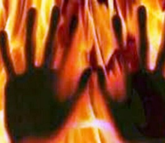 Jammu Kashmir: Woman Suffers 70 Per Cent Burns as Stepson Allegedly Sets Her Ablaze