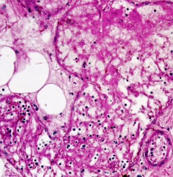 Fungus: A Silent Threat to Crops and Human Life