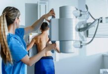 The Radiation Costs