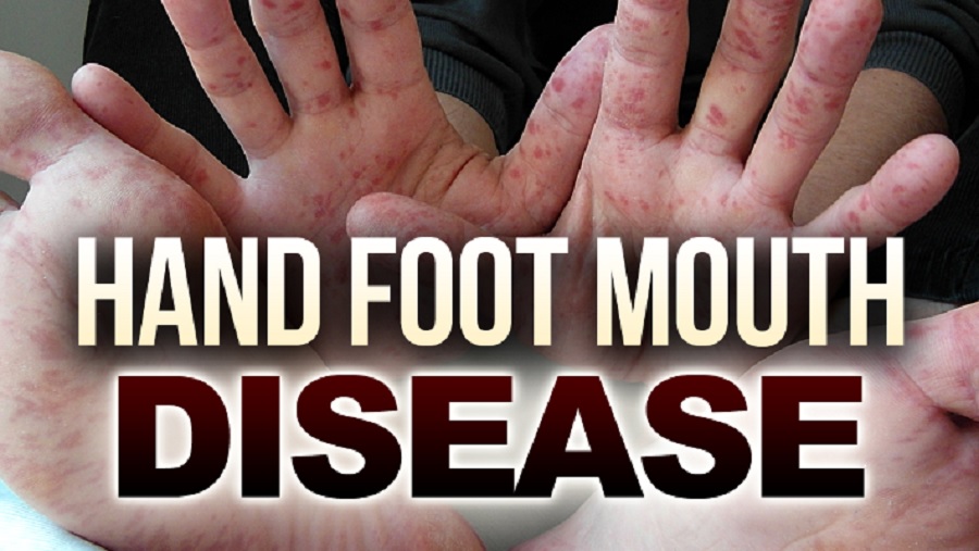 Hand, mouth, foot disease